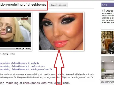 РАЗКРИХМЕ Я! Ето го доказателството, че Николета има пластики! (СНИМКИ)