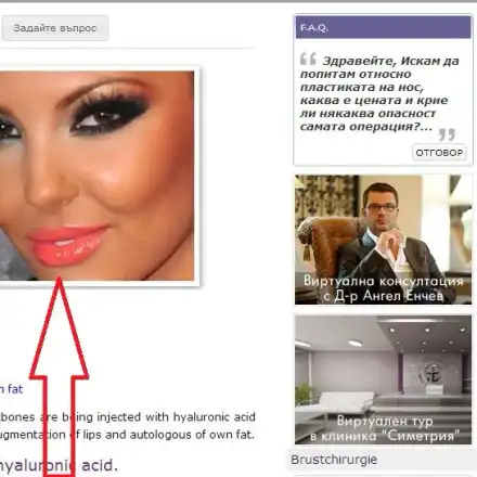 РАЗКРИХМЕ Я! Ето го доказателството, че Николета има пластики! (СНИМКИ)