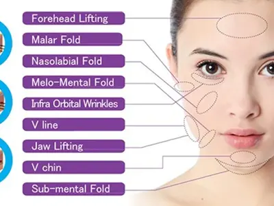 БГ звезди луднаха по конци за лифтиране на лицето и тялото