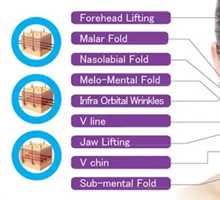 БГ звезди луднаха по конци за лифтиране на лицето и тялото