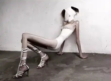 Топ 5 на най-странните методи за отслабване