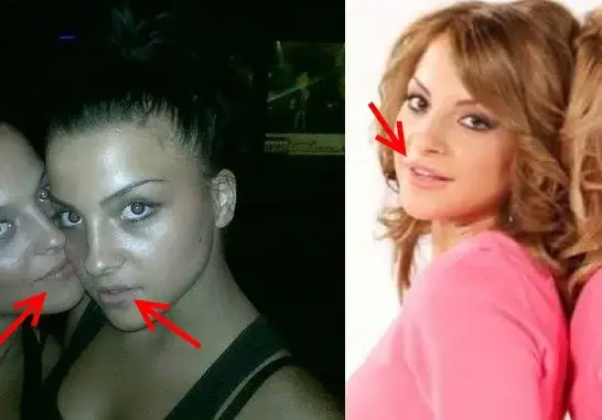 Близначките от Мис България преди тунинга (СНИМКИ)