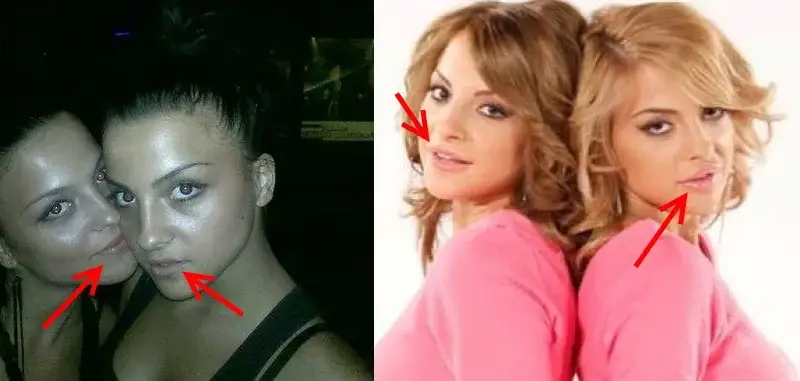 Близначките от Мис България преди тунинга (СНИМКИ)