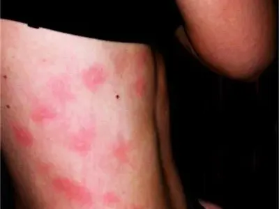 УНИКАЛНИ СТРАННОСТИ! Жена припада, като се усмихне, мъж не чувства студ!