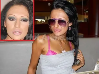 О, НЕ! Вижте новата на Божинов преди пластичните операции (СТРАХОВИТИ СНИМКИ)