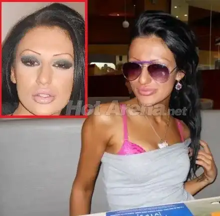 О, НЕ! Вижте новата на Божинов преди пластичните операции (СТРАХОВИТИ СНИМКИ)