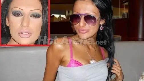 О, НЕ! Вижте новата на Божинов преди пластичните операции (СТРАХОВИТИ СНИМКИ)