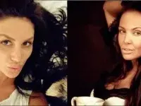 О, НЕ! Вижте новата на Божинов преди пластичните операции (СТРАХОВИТИ СНИМКИ)