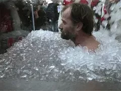 УНИКАЛНИ СТРАННОСТИ! Жена припада, като се усмихне, мъж не чувства студ!
