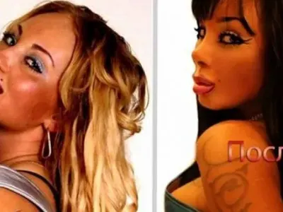 Руска певица се съсипа с 13 пластични операции (Снимки)