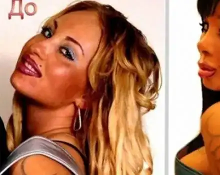 Руска певица се съсипа с 13 пластични операции (Снимки)