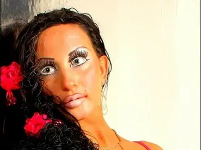 Руска певица се съсипа с 13 пластични операции (Снимки)