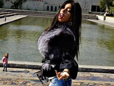 Руска певица се съсипа с 13 пластични операции (Снимки)