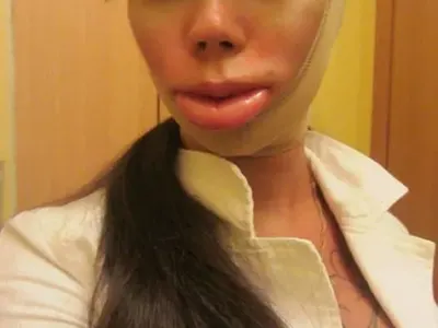 Руска певица се съсипа с 13 пластични операции (Снимки)