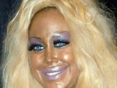 ТОП 5 на най-НЕСПОЛУЧЛИВИТЕ пластични операции! (ПОТРЕСАВАЩИ СНИМКИ)