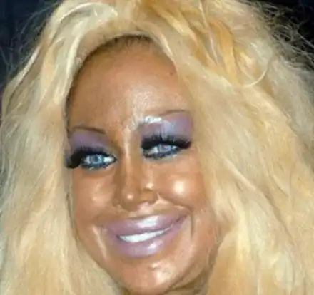 ТОП 5 на най-НЕСПОЛУЧЛИВИТЕ пластични операции! (ПОТРЕСАВАЩИ СНИМКИ)