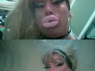 ТОП 5 на най-НЕСПОЛУЧЛИВИТЕ пластични операции! (ПОТРЕСАВАЩИ СНИМКИ)