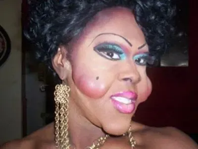 ТОП 5 на най-НЕСПОЛУЧЛИВИТЕ пластични операции! (ПОТРЕСАВАЩИ СНИМКИ)