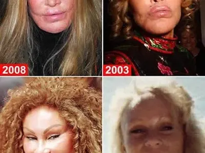 ТОП 5 на най-НЕСПОЛУЧЛИВИТЕ пластични операции! (ПОТРЕСАВАЩИ СНИМКИ)