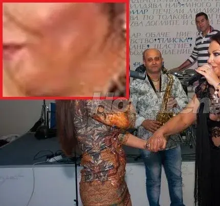 След дълго отсъствие! Ивана се появи БИТА на участие?! (Виж с какви синини по лицето)