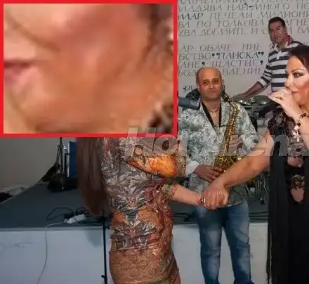 След дълго отсъствие! Ивана се появи БИТА на участие?! (Виж с какви синини по лицето)