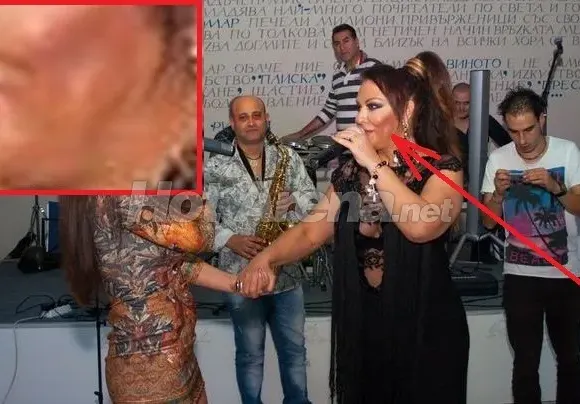 След дълго отсъствие! Ивана се появи БИТА на участие?! (Виж с какви синини по лицето)