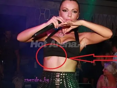 Вече стана ПРИТЕСНИТЕЛНО! Галена пак посинена – този път и по устата! (ФОТО)