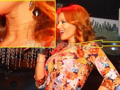 Виенски хирург окепази Емилия? Певицата се сбръчка! (Сложи и нови гърди + СНИМКИ)