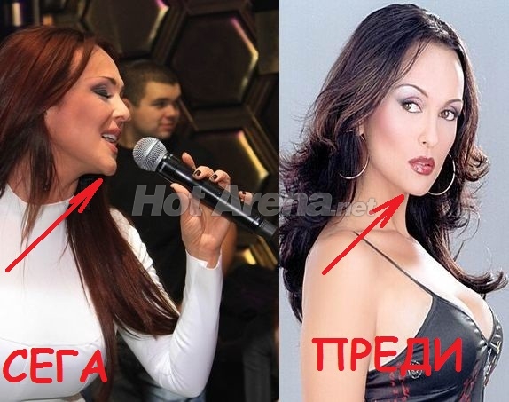 Глория рекордьорка по пластики! Оперира си и брадичката! (Нови снимки с промяната)