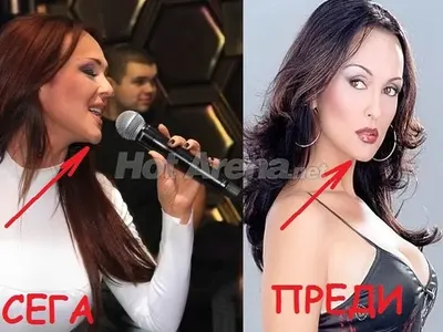 Глория рекордьорка по пластики! Оперира си и брадичката! (Нови снимки с промяната)