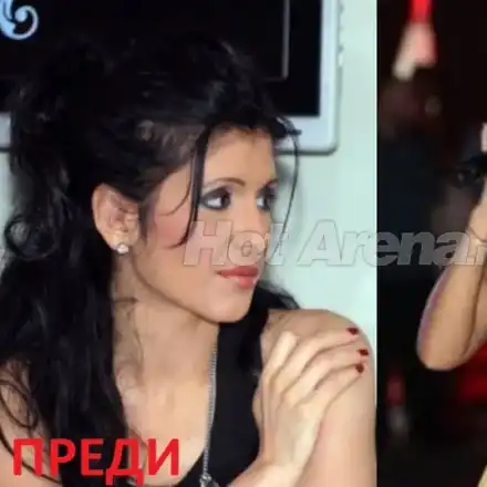 Очевидец: Анелия е обезобразена! Изду джуки, прилича на ужилена! (Разказ на фен)