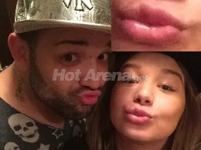 Устата на Грахич се ИЗКРИВИ от много силикон! (Последните й изцепки със СНИМКИ)