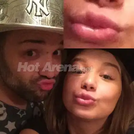 Устата на Грахич се ИЗКРИВИ от много силикон! (Последните й изцепки със СНИМКИ)