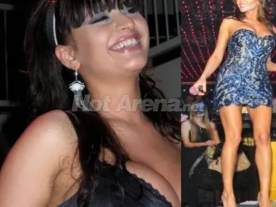 Топ 5 на бг звездите, които се обезобразиха заради комплексите си (СНИМКИ)