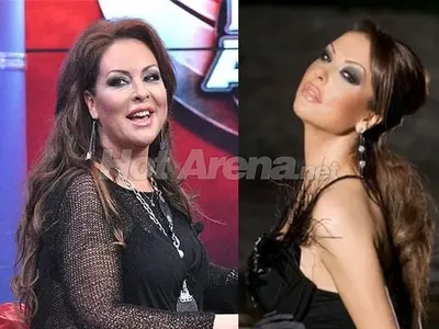 Топ 5 на бг звездите, които се обезобразиха заради комплексите си (СНИМКИ)