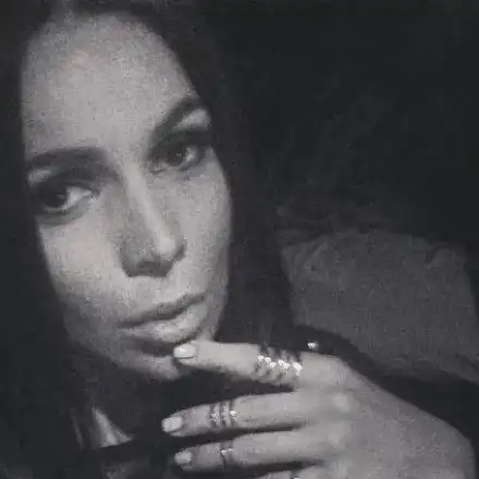 Скъпарска процедура развали лицето на Алисия! Вижте какво се случи с кожата й (ФОТО)