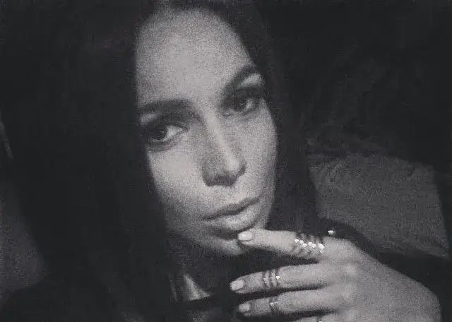 Скъпарска процедура развали лицето на Алисия! Вижте какво се случи с кожата й (ФОТО)