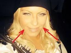 Ботокс ВЦЕПЕНИ Камелия! Заглади бръчките, но не може да се усмихне! (ФОТО)