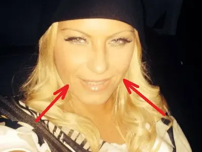 Ботокс ВЦЕПЕНИ Камелия! Заглади бръчките, но не може да се усмихне! (ФОТО)