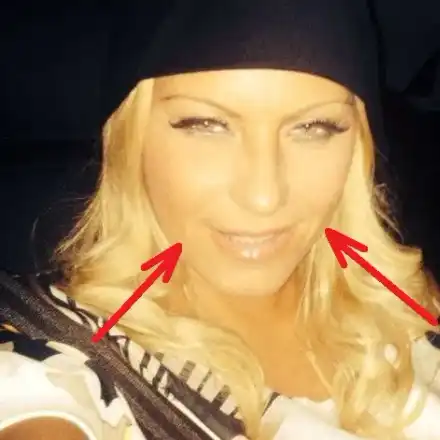 Ботокс ВЦЕПЕНИ Камелия! Заглади бръчките, но не може да се усмихне! (ФОТО)