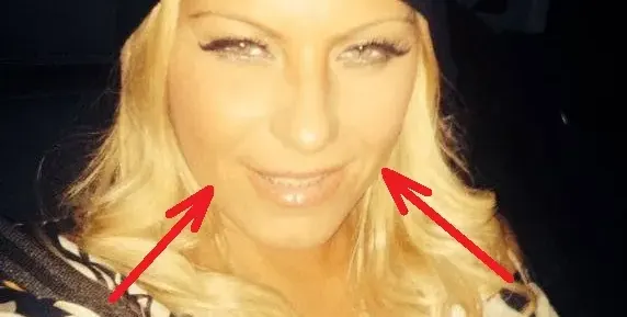 Ботокс ВЦЕПЕНИ Камелия! Заглади бръчките, но не може да се усмихне! (ФОТО)