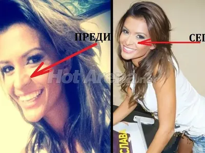 Преслава, защо?! Първата операция на певицата е факт! Вижте новия нос + отзивите на фенове