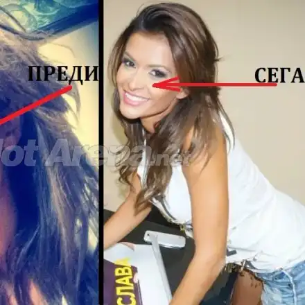 Преслава, защо?! Първата операция на певицата е факт! Вижте новия нос + отзивите на фенове