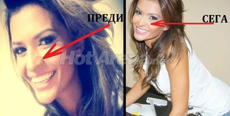 Преслава, защо?! Първата операция на певицата е факт! Вижте новия нос + отзивите на фенове