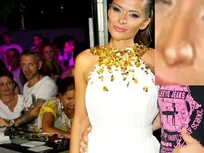 Преслава, защо?! Първата операция на певицата е факт! Вижте новия нос + отзивите на фенове