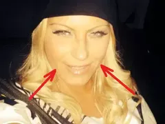 Ботокс ВЦЕПЕНИ Камелия! Заглади бръчките, но не може да се усмихне! (ФОТО)