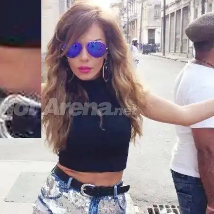 Махала ли си е ребра Галена, за да е по-слаба? (ФОТО със странен белег)