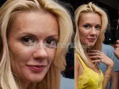 Какво става с лицето на Мария Игнатова? Тв водещата цялата в пъпки! (ФОТО)