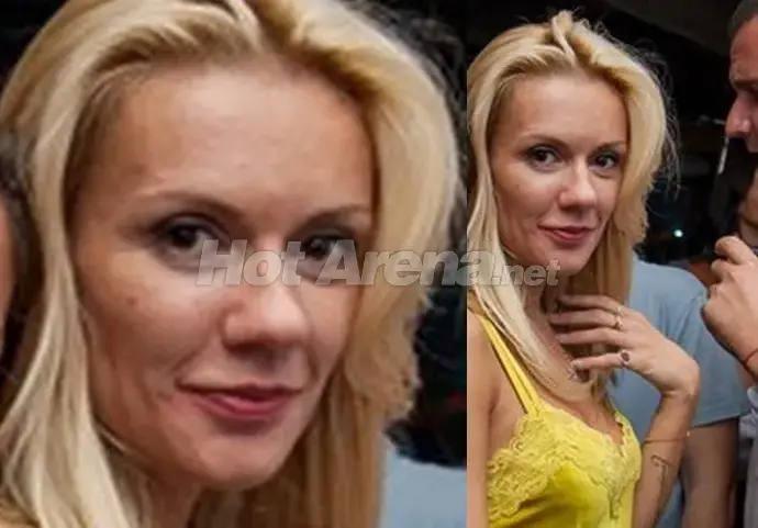 Какво става с лицето на Мария Игнатова? Тв водещата цялата в пъпки! (ФОТО)