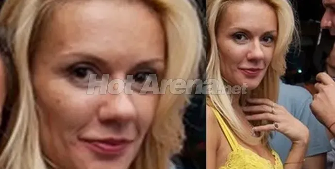 Какво става с лицето на Мария Игнатова? Тв водещата цялата в пъпки! (ФОТО)